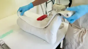 Un technicien orthopédiste travaille sur un moulage de jambe personnalisé avec des gants bleus.